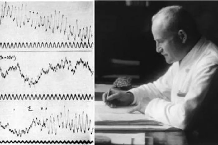 Năm 1924, Tiến sĩ Hans Berger - bác sĩ tâm thần người Đức, đã phát minh ra điện não đồ đầu tiên ở người. Dù vấp phải hoài nghi, 5 năm sau ông mới thực sự công bố kỹ thuật ghi lại hoạt động điện của não người