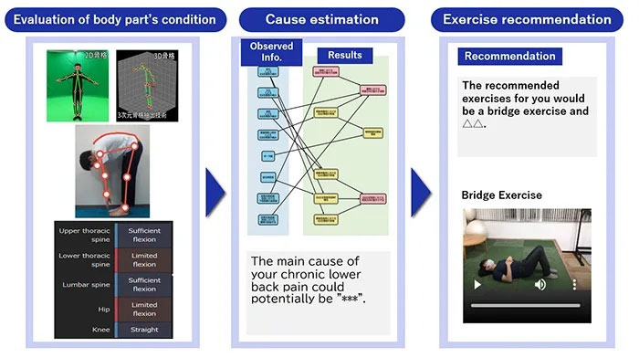 NEC và Đại học Y và Nha khoa Tokyo sử dụng AI để hỗ trợ tự chăm sóc chứng đau lưng mãn tính. (Ảnh: acnnewswire.com)